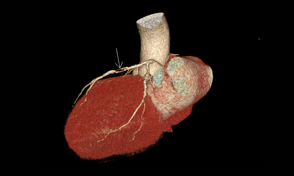 Image 3D d'un coeur